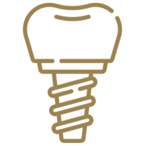 Implantes Dentários